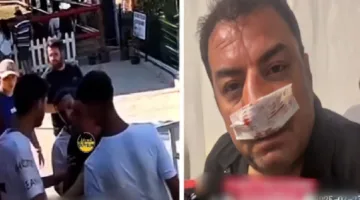 اعتداءات أتراك على سائق عائلة عربية بسبب خلاف على أسعار التصوير.. فيديو جديد يثير الجدل